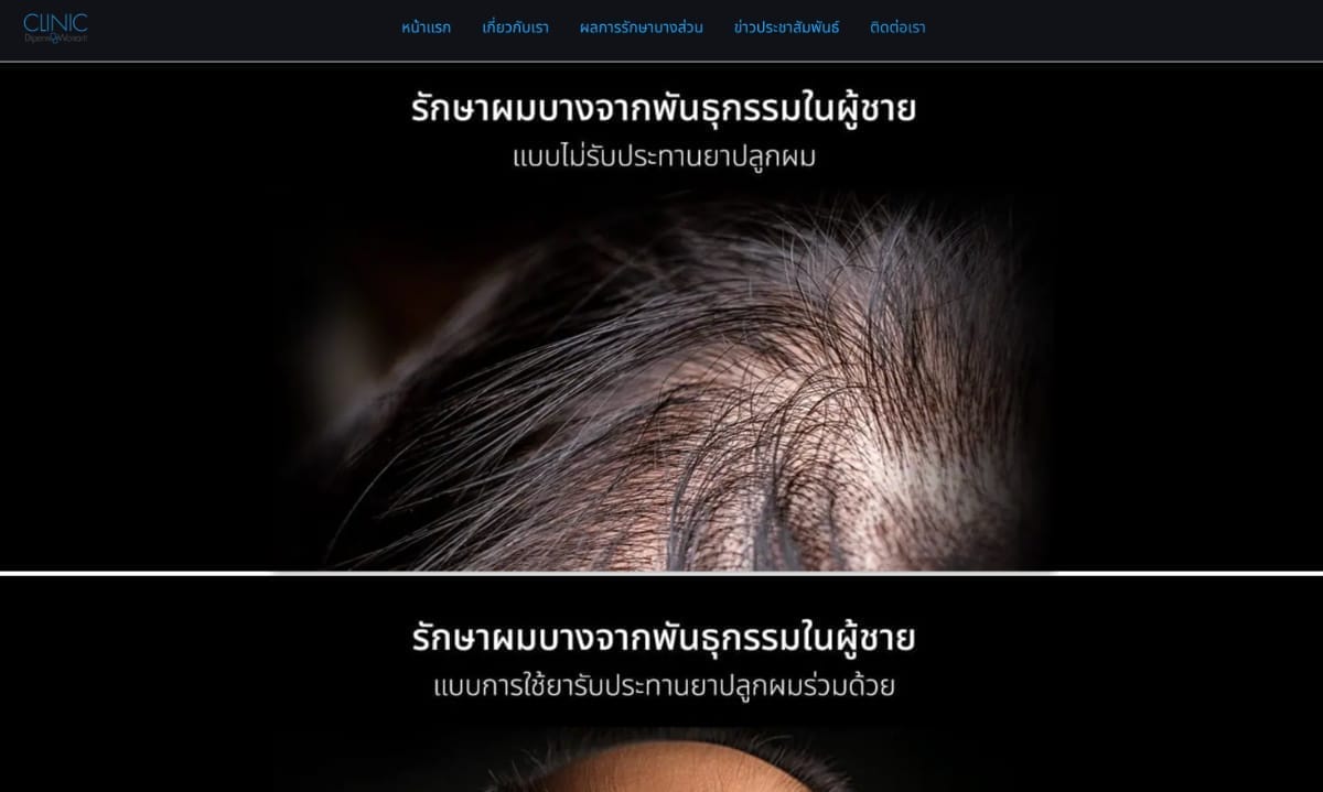 ผมร่วงผมบางดีเพ็ญ